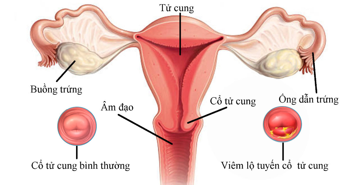 Các Phương Pháp Chẩn Đoán U Hạ Vị